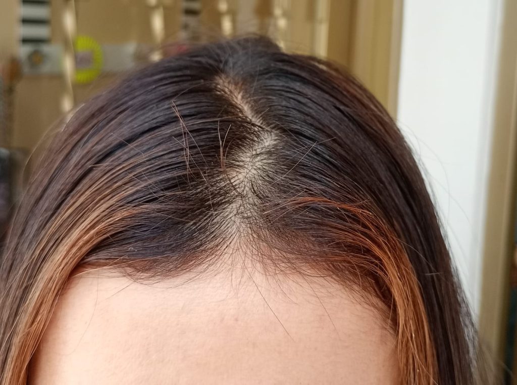 After Healthy Hair Serum