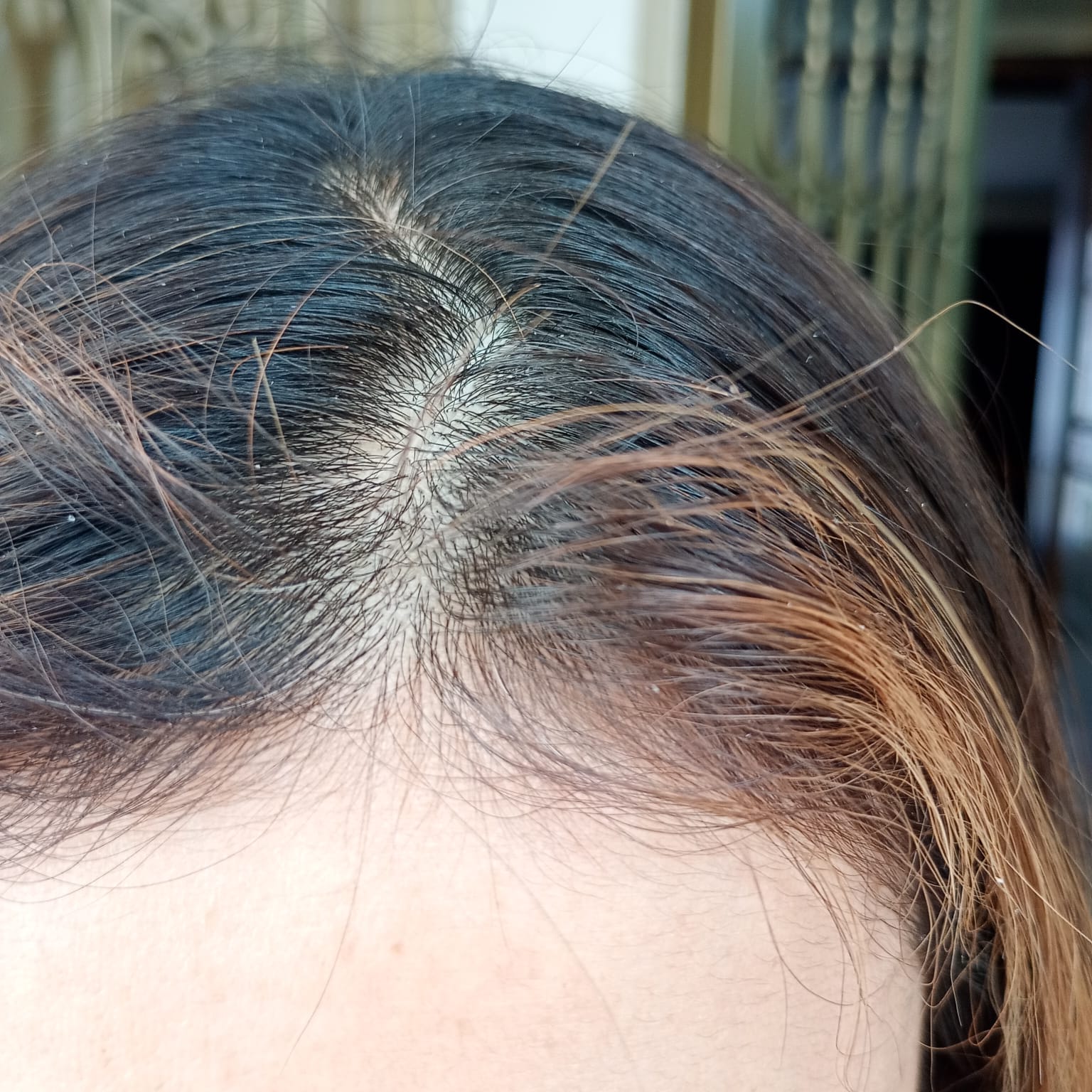 Before Healthy Hair Serum