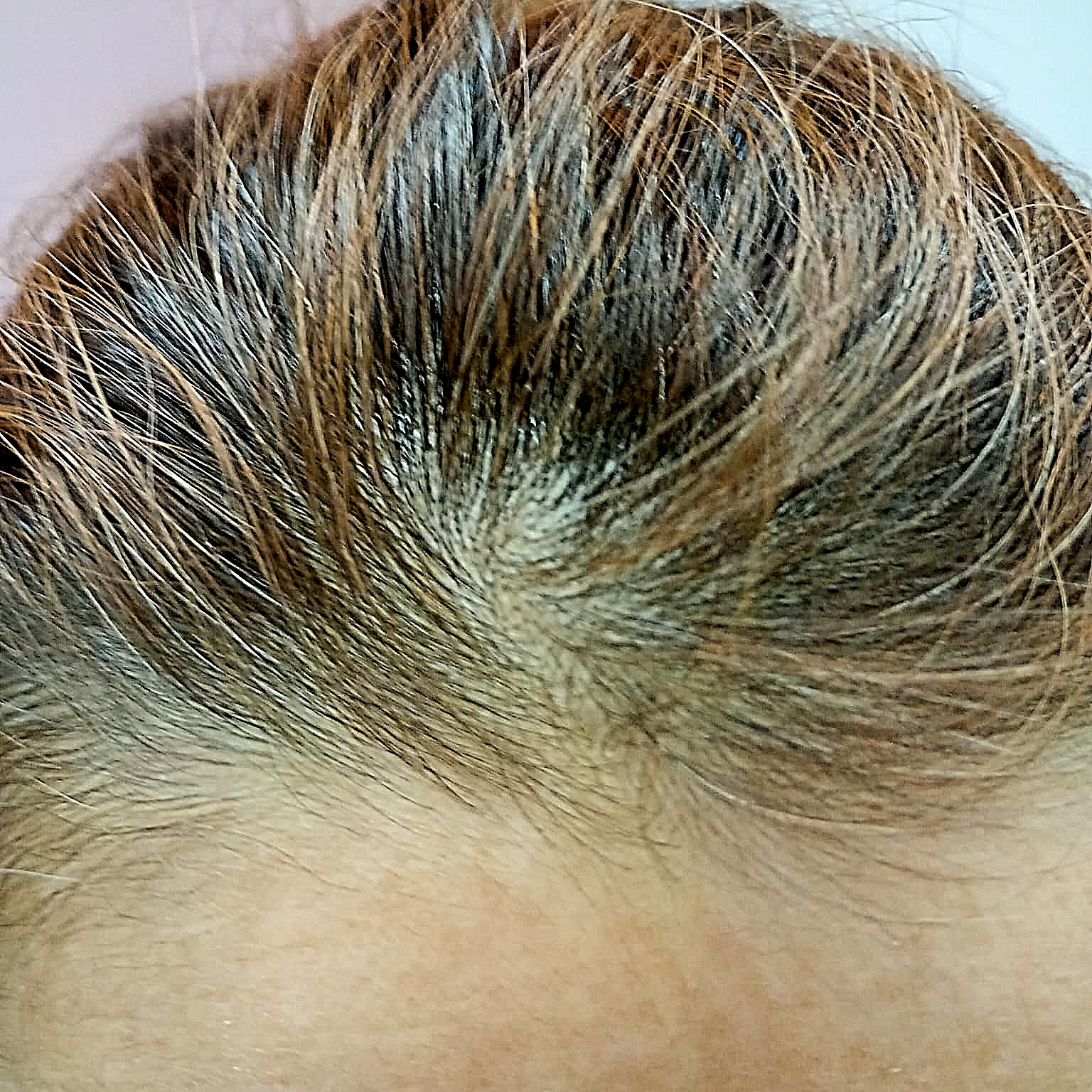 Before Healthy Hair Serum